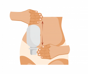 Sacca per stomia sul lato destro dell’addome