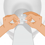 osoba stomijna zamykająca worek stomijny