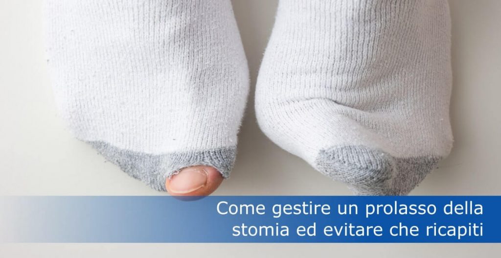 How to manage an ostomy prolapse title image