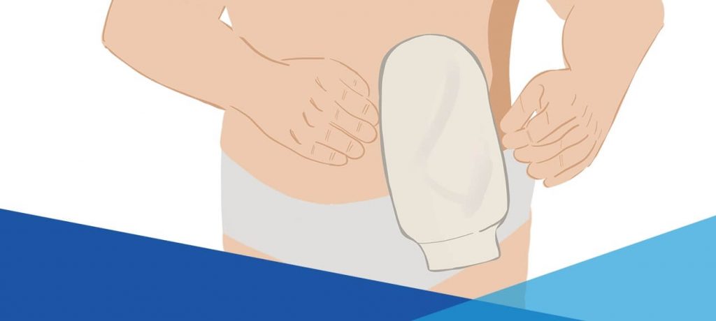 zdjąć mankiet (i wyczyścić go)