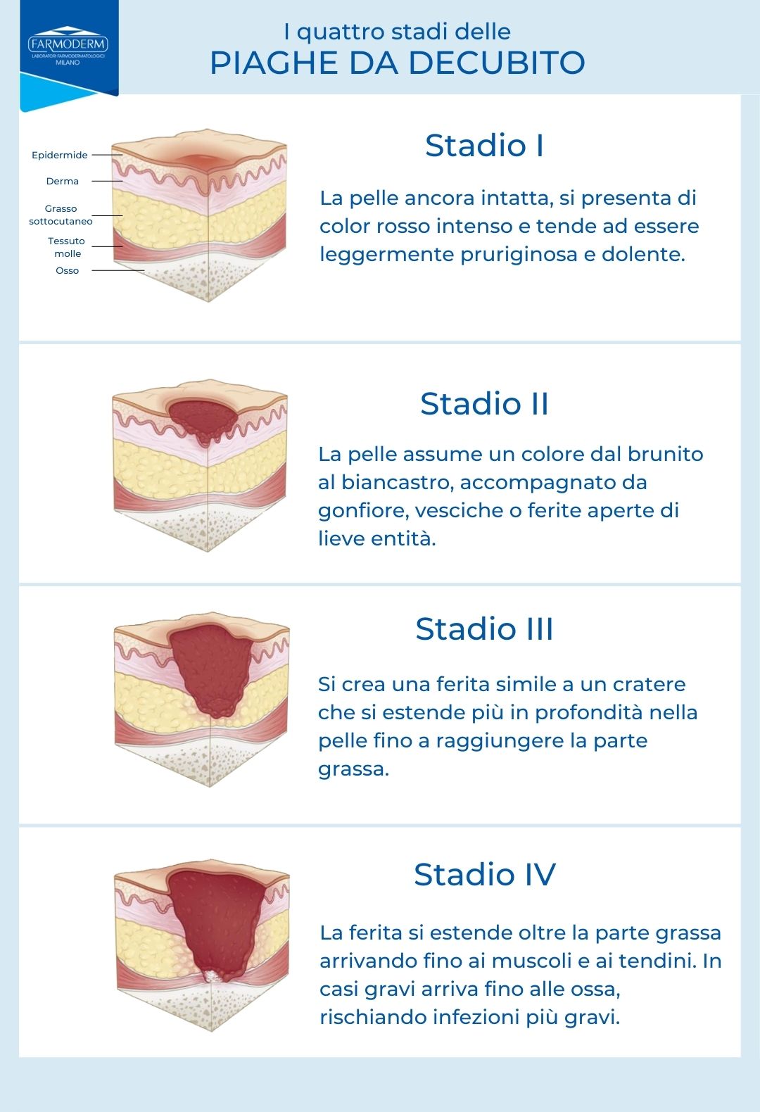 4 stadi delle piaghe da decubito